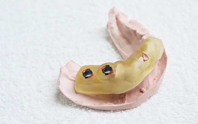 ガイデッドサージェリー