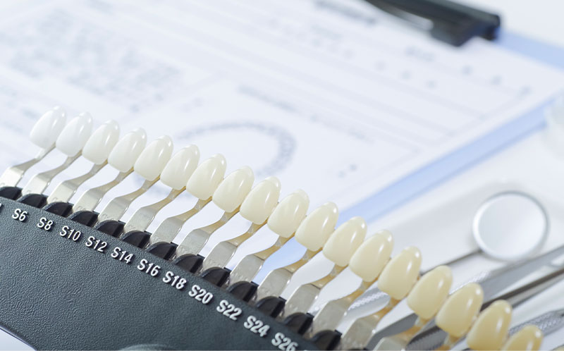 ホワイトニング